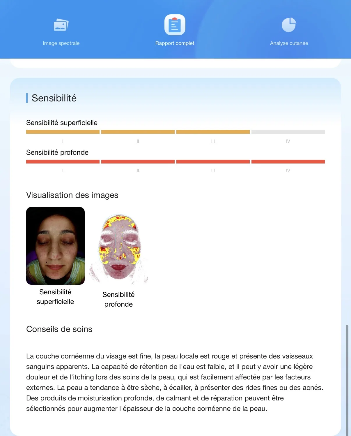 Rapport LUNASKIN — Sensibilité